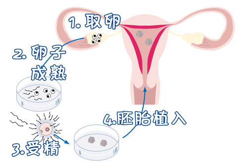 代生儿子机构